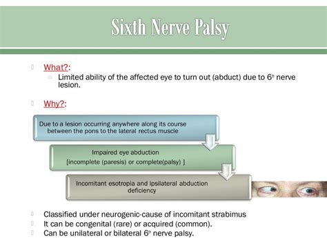 Sixth nerve palsy