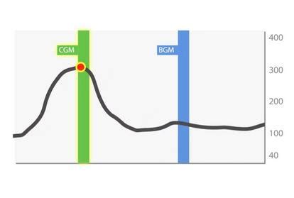 Dexcom G7 CGM System FAQs | Dexcom