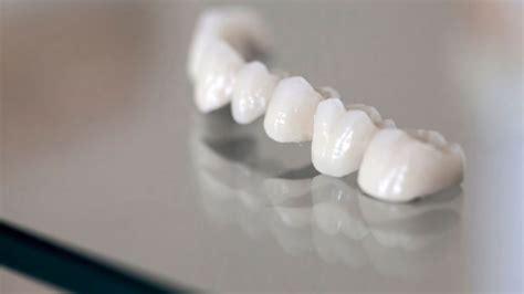 Zirconium Dental Crowns: Details, Cost and Procedure [2023] - Maltepe Dental Clinic