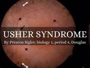 Usher Syndrome by Preston Sigler