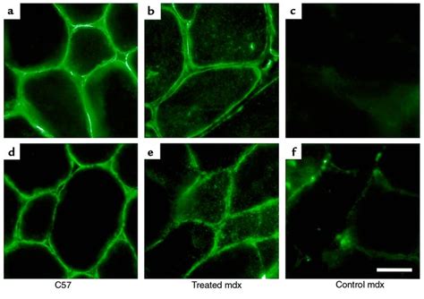 JCI - Aminoglycoside antibiotics restore dystrophin function to ...