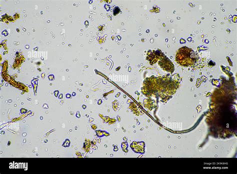 Fungal and fungi hyphae under the microscope in the soil and compost ...