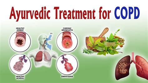 Home Remedies For Chronic Obstructive Pulmonary Disease Copd – Otosection