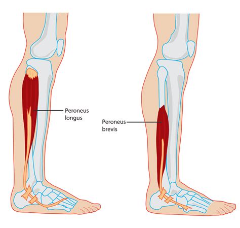 Peroneal Tendonitis And The Best Stretches To Relieve Pain | Physiotherapists in Toronto ...