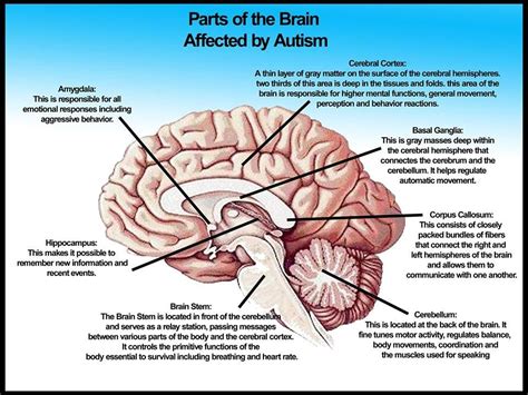 Part of the brain affected by ASD | What is autism, Cognitive enhancement