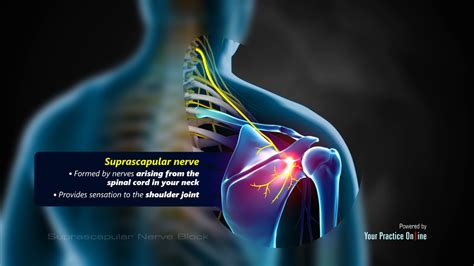 Suprascapular Nerve Block Video | Medical Video Library