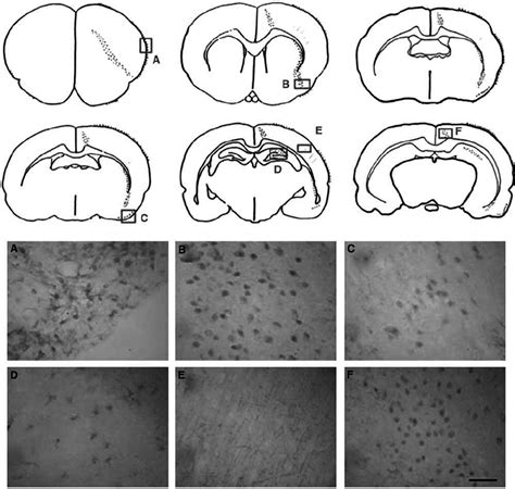 The regional distribution of prostacyclin synthase (PGIS) protein in ...