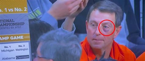 Woah, What Happened? Dabo Swinney Shows Up To UNC-Clemson Basketball Game With Massive Black Eye ...