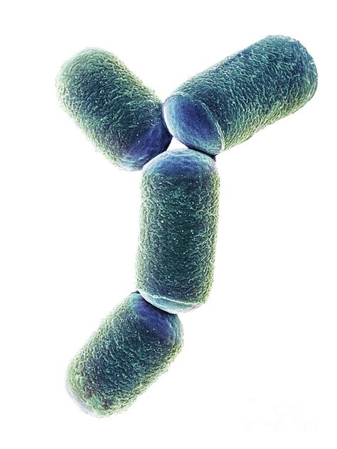 Intestine Archaea Methanobrevibacter Smithii Photograph by Dennis ...