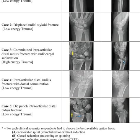 Clinical Scenarios Used to Evaluate Treatment of Distal Radius ...