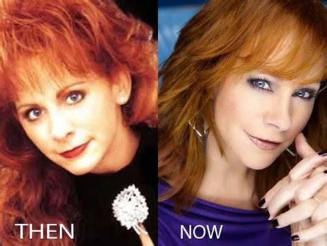 Reba McEntire Plastic Surgery