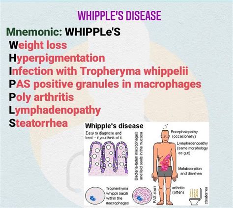 Whipple disease - MEDizzy