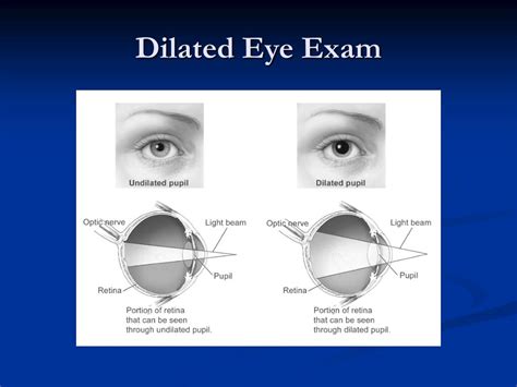 PPT - Pediatric Ocular Trauma and Emergencies PowerPoint Presentation, free download - ID:602349