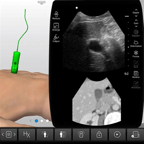 Ultrasound Training - Bile Ducts, Gallbladder Anatomy & Physiology