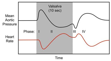 Valsalva Maneuver Ultrasound