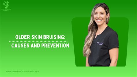 Older Skin Bruising: Causes And Prevention %site