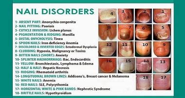 Fingernail disorders, fingernail changes, fingernail disease, abnormalities