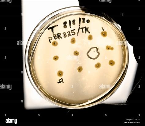 A technician holds petri dish culture medium. In this recombinant DNA ...