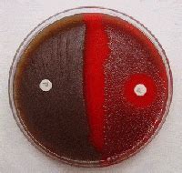 Optochin Sensitivity Test: Principle, Procedure, expected results and ...