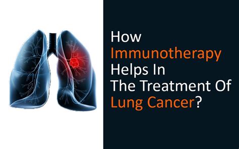 Immunotherapy treatment for lung cancer in India - Best hospitals