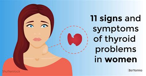 Thyroid Symptoms In Women / 11 signs and symptoms of thyroid problems in women - Having low ...