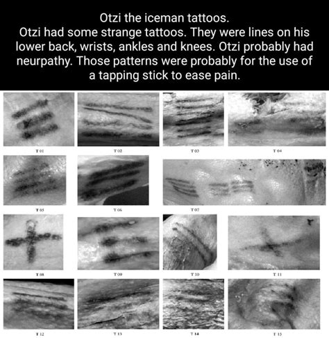 Otzi the iceman tattoos. Otzi had some strange tattoos. They were lines ...