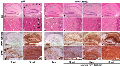 Prevention of neuronal loss and reversal of early spongiosis in... | Download Scientific Diagram