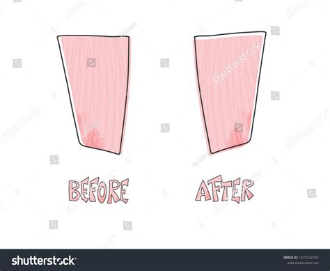 Before After Template Background Comparison Concept Stock Vector ...