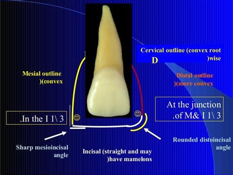 Upper Central Incisor