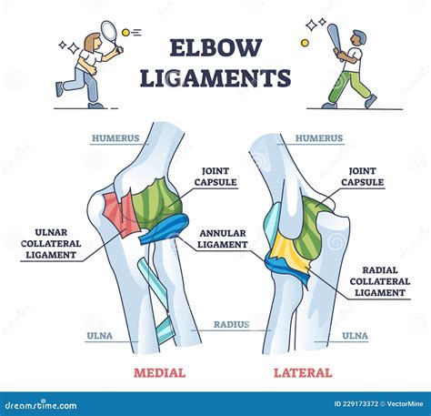 Elbow Ligaments with Medical Medial or Lateral Xray Structure Outline Diagram Stock Vector ...