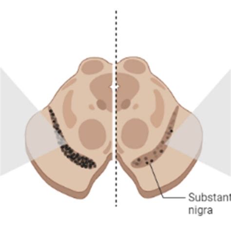 A schematic diagram of substantia nigra pars compacta region of healthy... | Download Scientific ...