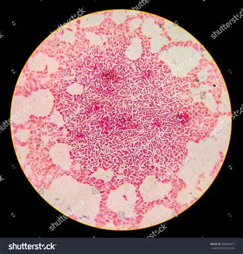 Escherichia Coli Gram Staining Compound Microscope库存照片568096879 ...