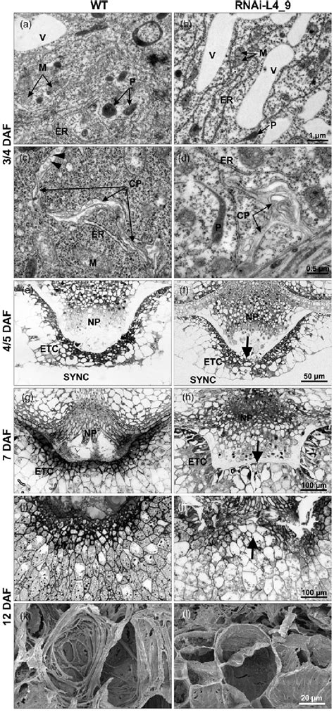 Morphological and ultrastructural analysis of the syncytium and the ...