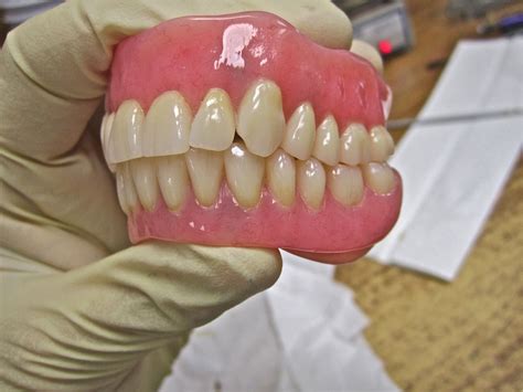 Cosmetic Natural Looking Dentures | Dentures Portland Oregon OR WA