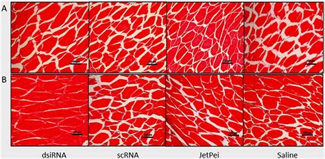 Cross sections of muscle fibers observed with optical microscope at ...