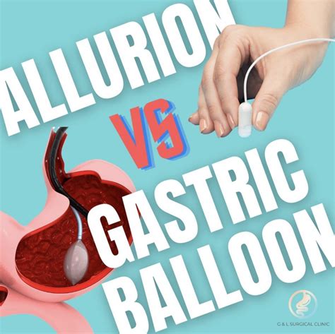 Allurion Elipse Balloon V.S. Gastric Balloon - Bariatric Clinic Singapore