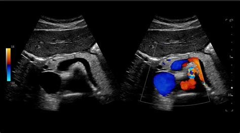 GE Logiq E10 – The Ultrasound Source