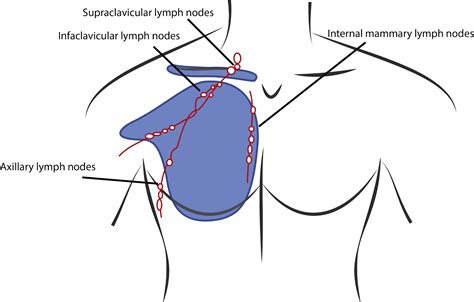 Male Breast Cancer Is Rare, Real, and Dangerous: One USU Professor ...