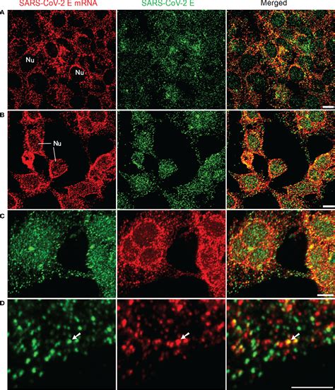 Frontiers | Development of a high-sensitivity and short-duration fluorescence in situ ...