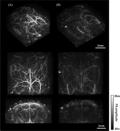 Frontiers | A Skull-Removed Chronic Cranial Window for Ultrasound and Photoacoustic Imaging of ...