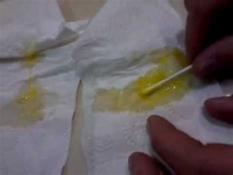 Yellow Snot - Sinus Infection - YouTube