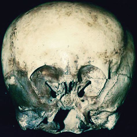 11 Best Starchild Skull images | Skull, Star children, Ancient aliens