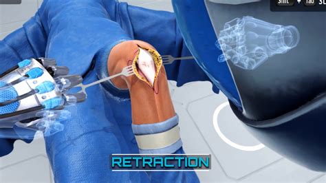 What types of procedures can be in our VR surgical simulator? | Video