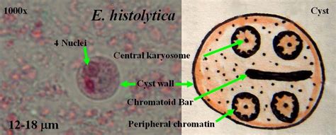 Cyst of E. histolytica | Medical Laboratories