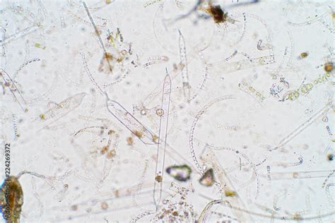 Marine aquatic plankton under microscope view Stock Photo | Adobe Stock