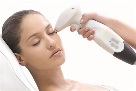 Laser Skin Lightening (Whitening) - Facts, Cost, Pros and Cons