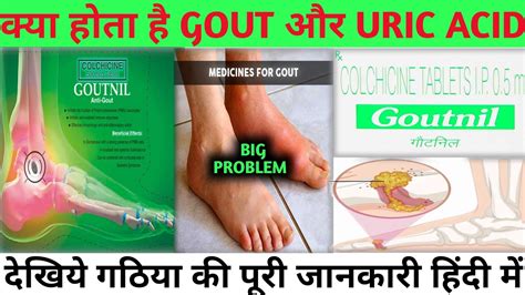 GOUTNIL TABLET REVIEW IN HINDI (COLCHICINE) URIC ACID - YouTube