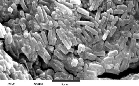 Ultra-structure of C. perfringens type A under SEM | Download ...