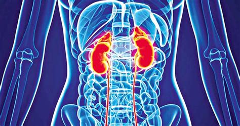 Alport syndrome causes, symptoms, diagnosis, prognosis & treatment