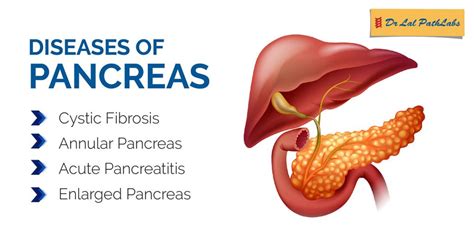 Pancreas: Functions, Diseases and Diagnosis | Dr. Lal PathLabs